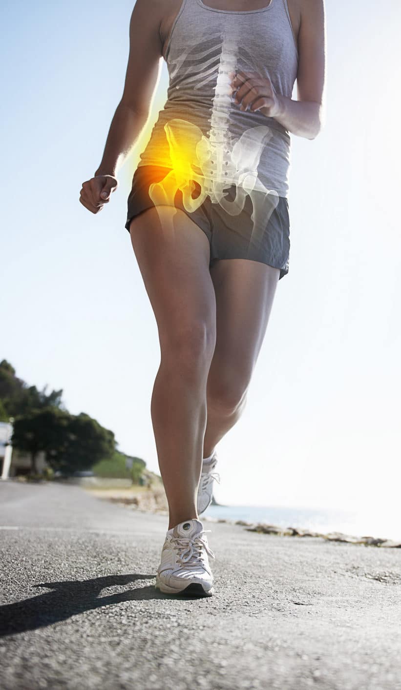 Hip Replacement Surgery Long Island, NY - lady running with image of hip pain