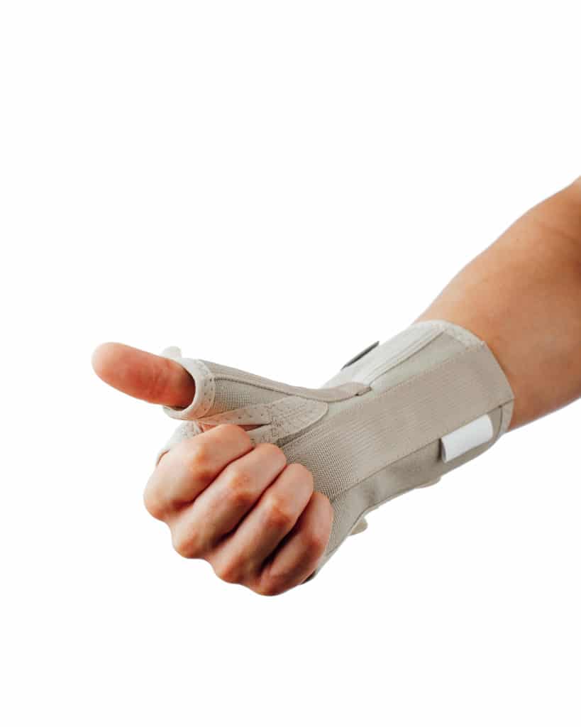 hand in splint for carpal tunnel syndrome