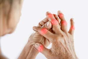 woman hand suffering from joint pain with gout in finger