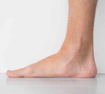 A close-up side view of flat feet with a bare foot showing a flat arch, standing on a smooth surface against a plain background.