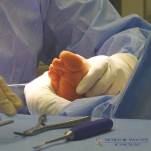 OALI LP (28) A medical professional wearing gloves holds a patient's foot during a surgical procedure, with surgical instruments and the Orthopedic Associates of Long Island logo visible